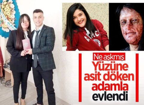 Üzünə “kislota” atıb onu kor edən adama ərə getdi – FOTOLAR
