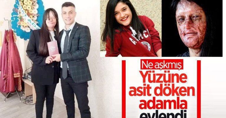 Üzünə “kislota” atıb onu kor edən adama ərə getdi – FOTOLAR Üzünə “kislota” atıb onu kor edən adama ərə getdi – FOTOLAR