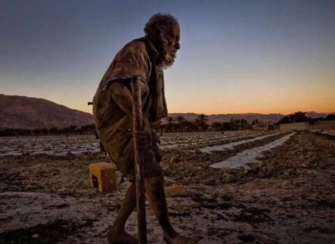 Həkimlər 67 ildir çimməyən şəxsi müayinə etdi: Nəticəyə inanmadılar – FOTOLAR