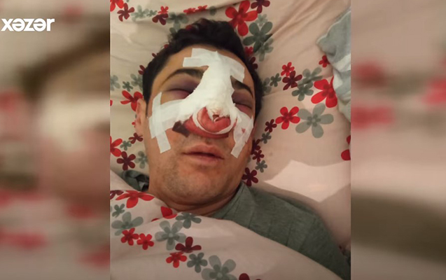 Bakıda avtobus sürücüsü döyüldü - ANBAAN VİDEO