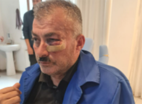 “Azəriqaz”ın əməkdaşına xəsarətlə bağlı cinayət işi açıldı