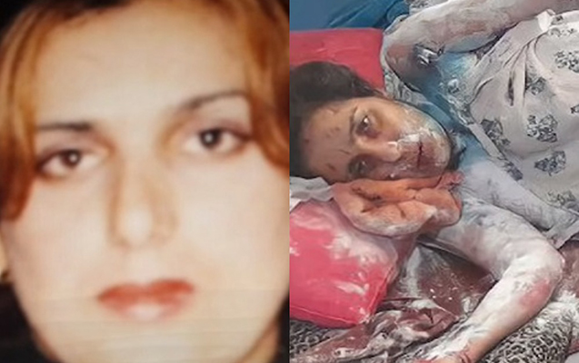 Qayınatası tərəfindən üzünə 
