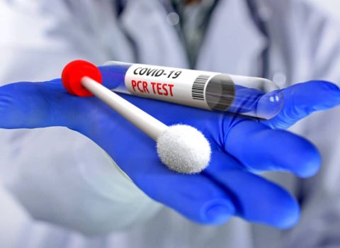 “Cəzaçəkmə müəssisələrində PCR testi tələbi absurddur və Operativ Qərargahın qərarına ziddir” – Partiya sədri