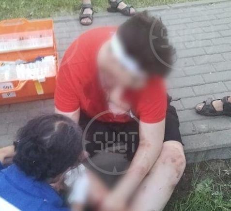 Elektron siqaret yeniyetmənin ağzında partladı - FOTO