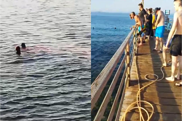 Misirdə köpək balığı turistin qolunu və ayağını dişlədi - VİDEO