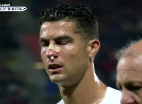 Ronaldu rəqib qapıçı ilə toqquşmadan sonra ciddi xəsarət aldı – FOTOLAR