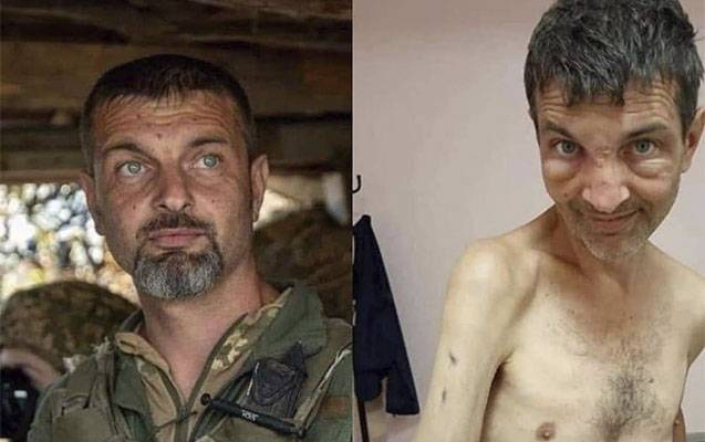 4 ay Rusiya əsirliyi “Azov döyüşçüsü”nü tanınmaz hala saldı – FOTOLAR