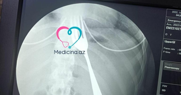 Bakıda 21 yaşlı qız çəngəl uddu – FOTO Bakıda 21 yaşlı qız çəngəl uddu – FOTO