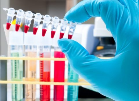Üç idmançımız antidopinq pozuntusuna görə cəzalandırıldı