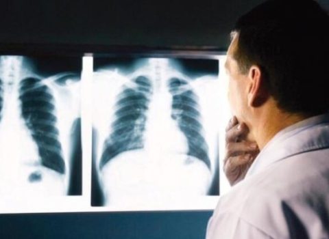 Baş ağrısı ilə həkimə getdi, boğazında mərmi tapıldı – 70 illik MÜƏMMA