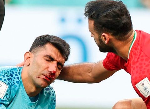 İran yığmasının qapıçısı DÇ-ni xərəkdə tərk etdi