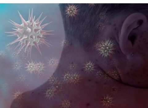 “COVİD”-19-dan sonra yeni virus yayılır – 3 nəfərdən birini öldürür