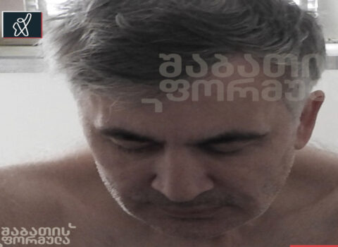 Saakaşvilinin müalicə aldığı xəstəxanadan fotoları YAYILDI