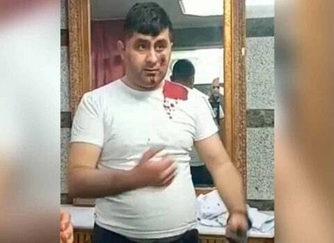 Terrorçunu zərərsizləşdirən Vasifin əməliyyatdan sonrakı – FOTOSU