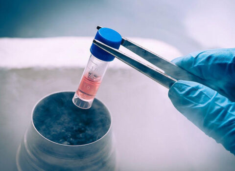 Yaponiya qandan alınan kök hüceyrələrin SATIŞINA BAŞLADI