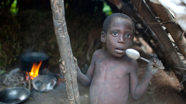 Afrikada yeni yoluxucu xəstəlik – 5 nəfər öldü