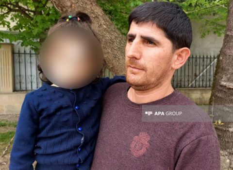 Astarada 4 yaşlı uşağı it dişlədi – FOTO