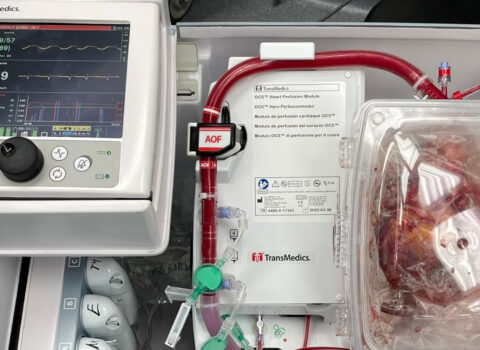 Azərbaycanda ürək transplantasiyası həyata keçiriləcək