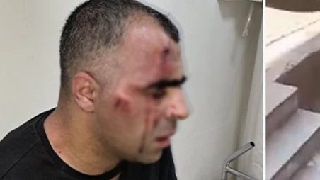 Türkiyədə jurnalisti döyən polis və bələdiyyə işçisi həbs edildi – VİDEO
