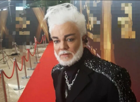 Kirkorov onu xilas etmək üçün həkimlərə yalvardı: “Güzgüdə özümə baxa bilmirəm”
