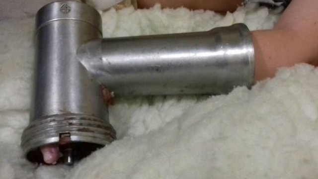Əli ət maşınında qalan azyaşlının barmaqları amputasiya olundu – YENİLƏNİB Əli ət maşınında qalan azyaşlının barmaqları amputasiya olundu – YENİLƏNİB