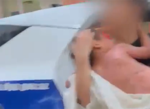 Yanan uşağı xəstəxanaya polis çatdırdı – VİDEO