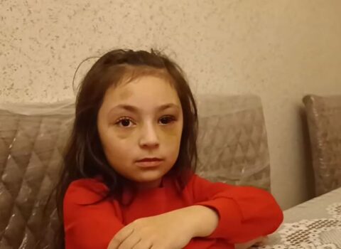 “Direktor maddiyyatla həll etmək istəyirdi” – Döyüldüyü deyilən məktəblinin anası – VİDEO