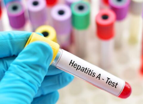 Regionlarda hepatit A virusuna yoluxma müşahidə edilir – TƏBİB