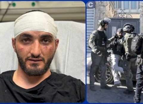 İsrail polisi “Anadolu”nun fotomüxbirini DÖYDÜ – DƏHŞƏTLİ GÖRÜNTÜLƏR