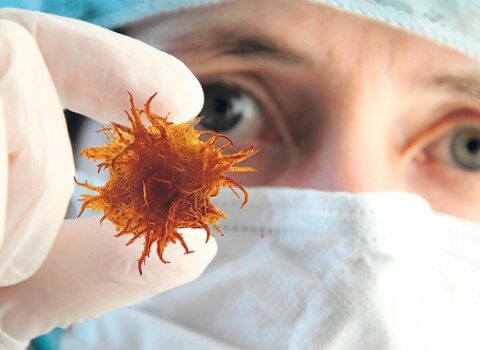 Süd vəzi xərçənginin ilkin əlamətləri AÇIQLANDI