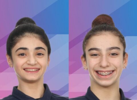 Azərbaycan gimnastları Almaniyada iki medal qazandı