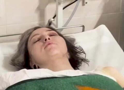 Terrorda yaralanan qız – “Özümü ölülüyə vurdum…” – VİDEO
