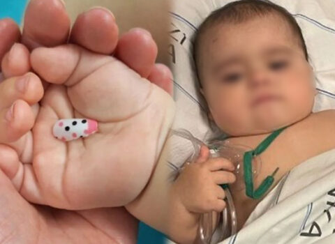 Bacısının dırnağı 6 aylıq körpəni xəstəxanalıq etdi – FOTO