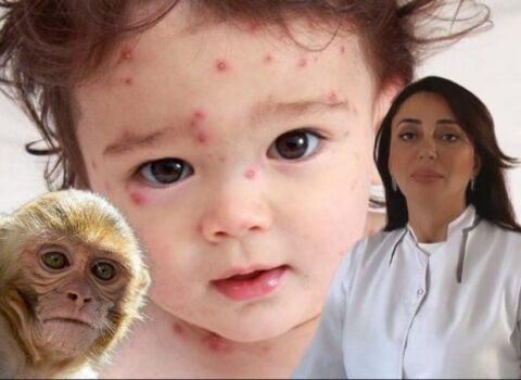 Həkimlərə HƏYƏCAN SİQNALI verildi: Uşaqlar arasında yeni virus YAYILACAQ