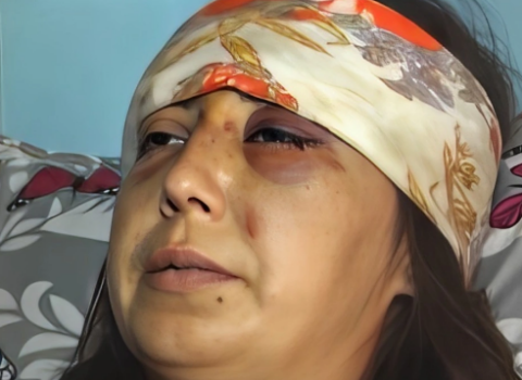 Bətnindəki körpənin cinsiyyəti qız olduğuna görə hamilə qadını döyərək uşağı tələf etdilər