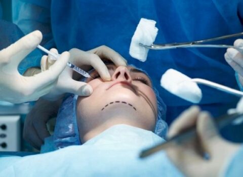 Plastik cərrahlara ayın sonunadək möhlət verildi – RƏSMİ