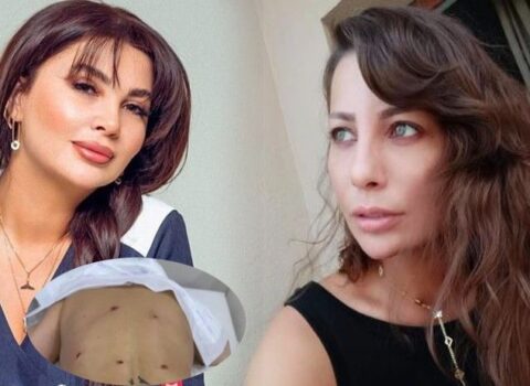 “Ülviyyə İlyasova məni uğursuz əməliyyat edib, indi də hədələyir”