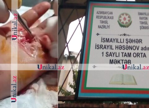 İsmayıllıda şagird sinif yoldaşını yaralayıb – Sinif rəhbəri hadisəni gizlədib + SƏS YAZISI