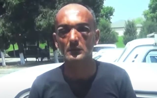 Toya gedən şəxs döyüləndən 9 gün sonra ölüb – VİDEO