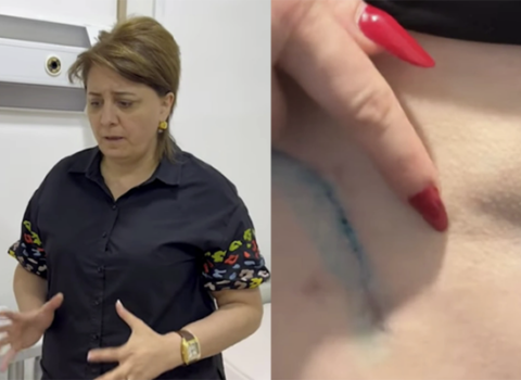 Daha bir “plastik cərrah” qalmaqalı – “Bədənim çürüyür”+Video