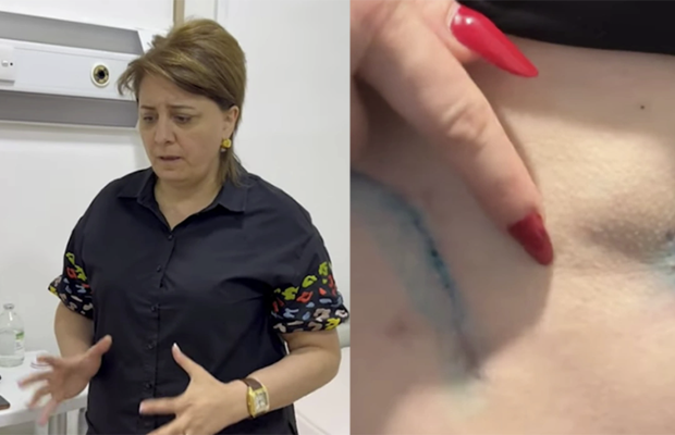 Daha bir “plastik cərrah” qalmaqalı – “Bədənim çürüyür”+Video