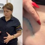 Prokurorluqda pasiyentin ölüm işində adı keçən həkim yenidən cərrahlıq edir? – VİDEO