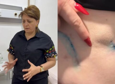 Prokurorluqda pasiyentin ölüm işində adı keçən həkim yenidən cərrahlıq edir? – VİDEO