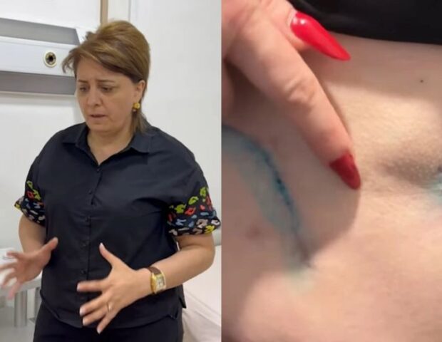 Prokurorluqda pasiyentin ölüm işində adı keçən həkim yenidən cərrahlıq edir? – VİDEO