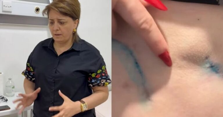 Prokurorluqda pasiyentin ölüm işində adı keçən həkim yenidən cərrahlıq edir? – VİDEO