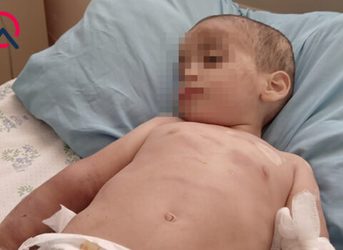 Valideynləri tərəfindən döyülən azyaşlının vəziyyəti ağırdır – TƏBİB