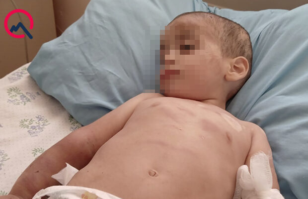 Ağdamda valideyn işgəncəsinə məruz qalan körpənin vəziyyəti AÇIQLANDI