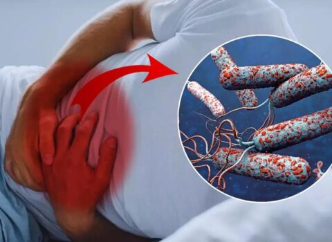 31 ölkədə xolera alarmı – Ölənlərin sayı sürətlə artır