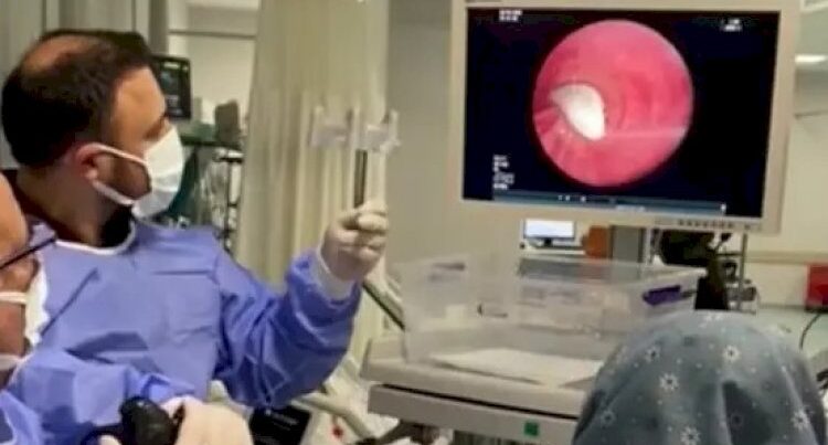 Təhlükəli virus yayıldı – Bu heyvandan insanlara keçir