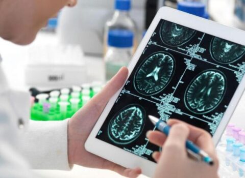 Alzheimerlə mübarizədə yeni ümid
